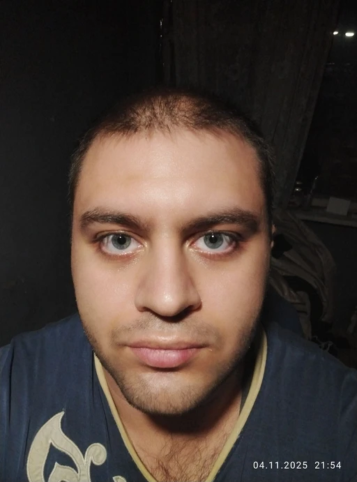 am I ugly🥲🥲🥲