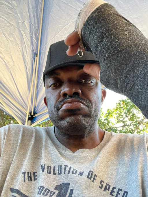 Waiting to take my cast off