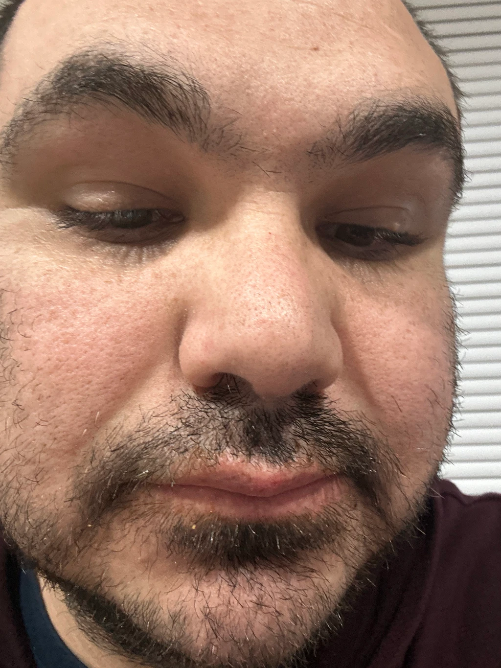 Anthony